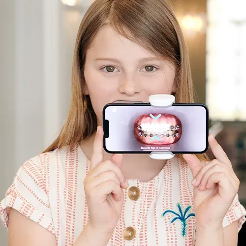 A girl holds a smartphone horizontally in front of her mouth, displaying an image of teeth with braces magnified for dental examination from Redmond Ridge Orthodontics.